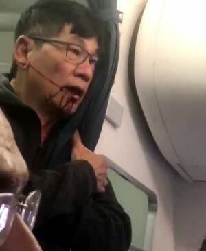 The man dragged from the overbooked United Airlines flight. Photo: Facebook